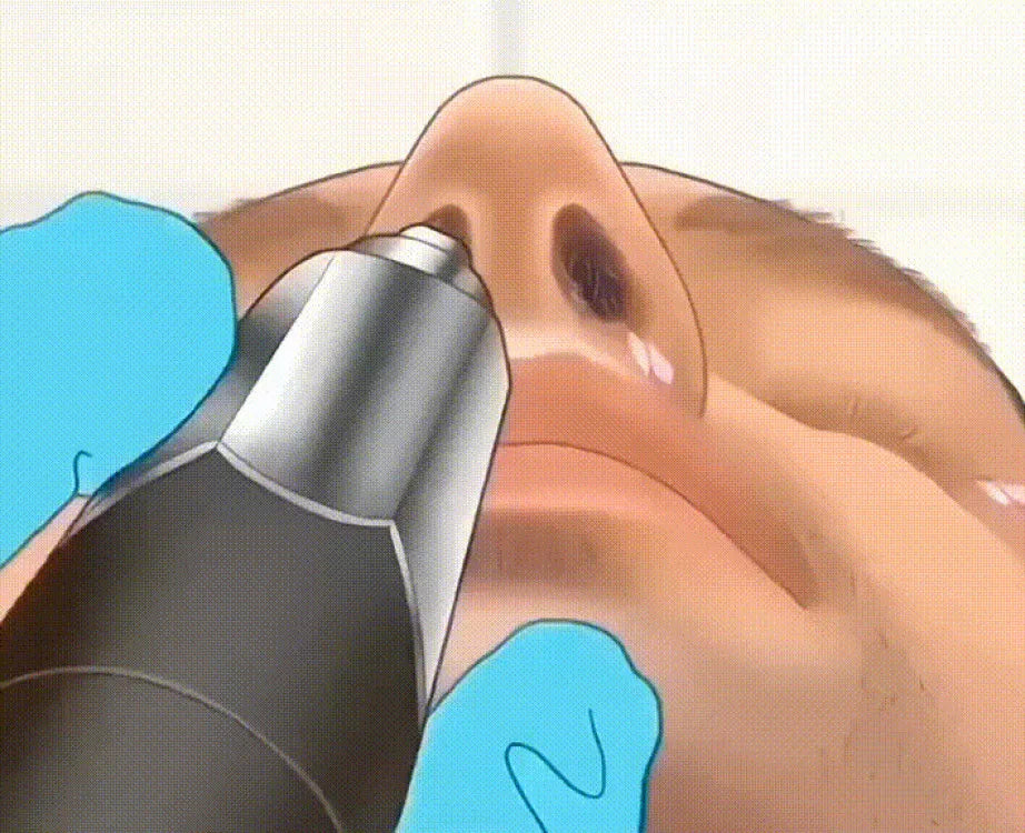 【Local Seller】Mini Portable Rechargeable Nose Hair Trimmer For Men Replacement Blades Included